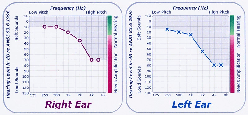 Hearing Test Audiogram